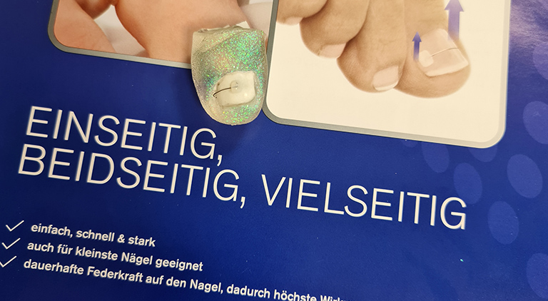  Nagelkorrekturspangen